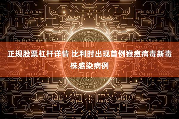 正规股票杠杆详情 比利时出现首例猴痘病毒新毒株感染病例
